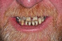 Smile In A Day 9 before